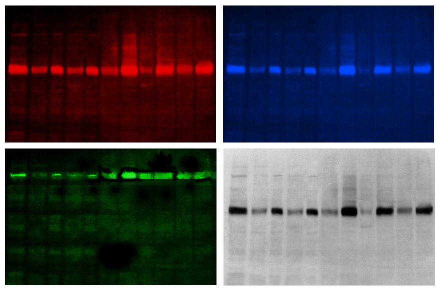 MILTIPLEX FLUORESCENTE